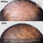 ADVANCED RAPID HAIR GROWTH SERUM BY DR.JAS (02 Pack bundle)